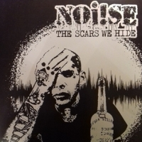 Noi!se The Scars We Hide