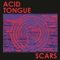 Acid Tongue Scars