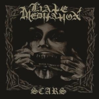 Scars